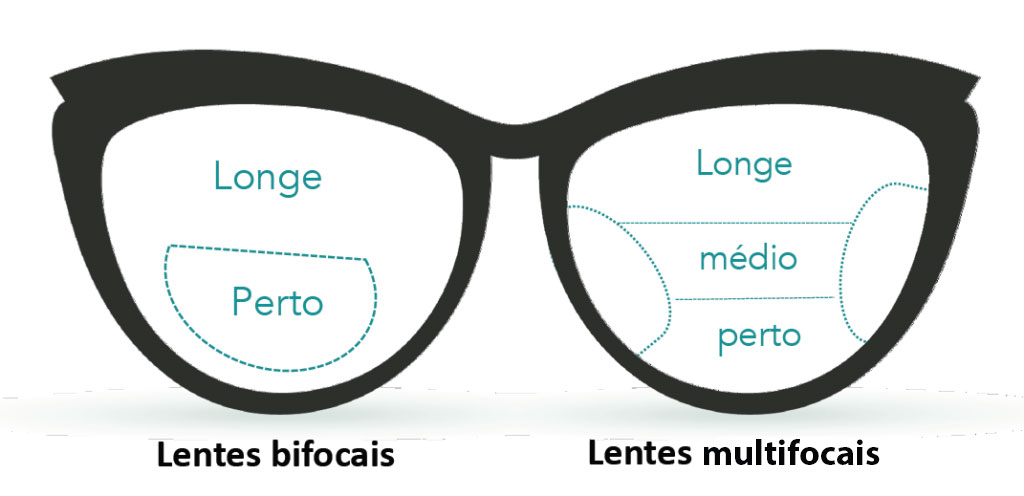 Figura representando lentes bifocais na esquerda e multifocais na direita