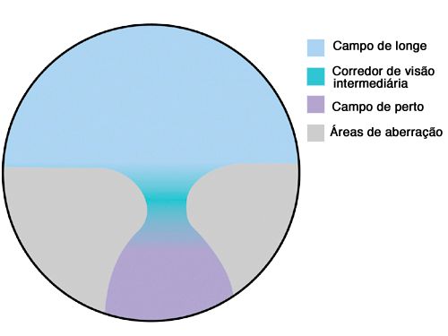 figura que representa a transição do grau em uma lente multifocal